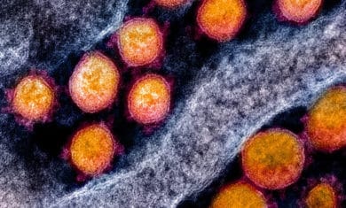 SARS-CoV-2 im Gewebe eines infizierten Menschen