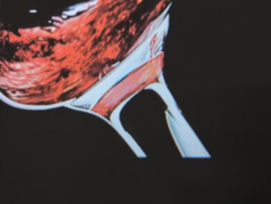 Testbild: Kurze Entfernung